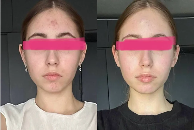 Проработана максилла